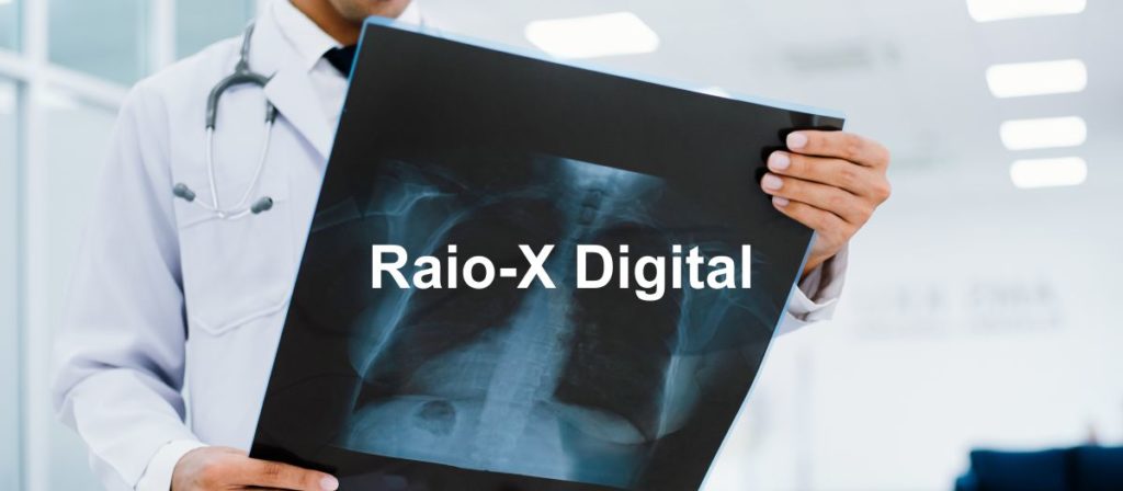 Raio-x Digital